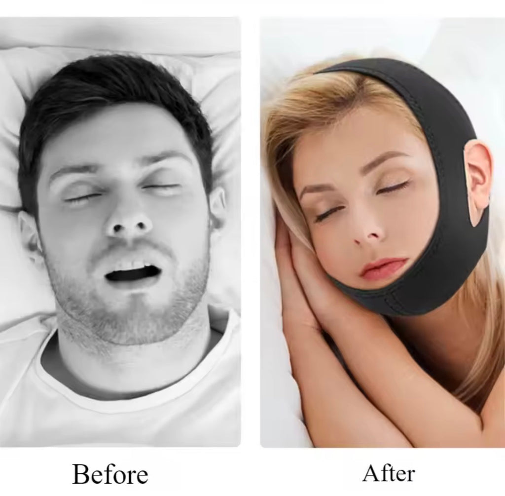 Anti-Snore Chin Strap – Comfortable Nighttime Snoring Support for Men &amp; Women
